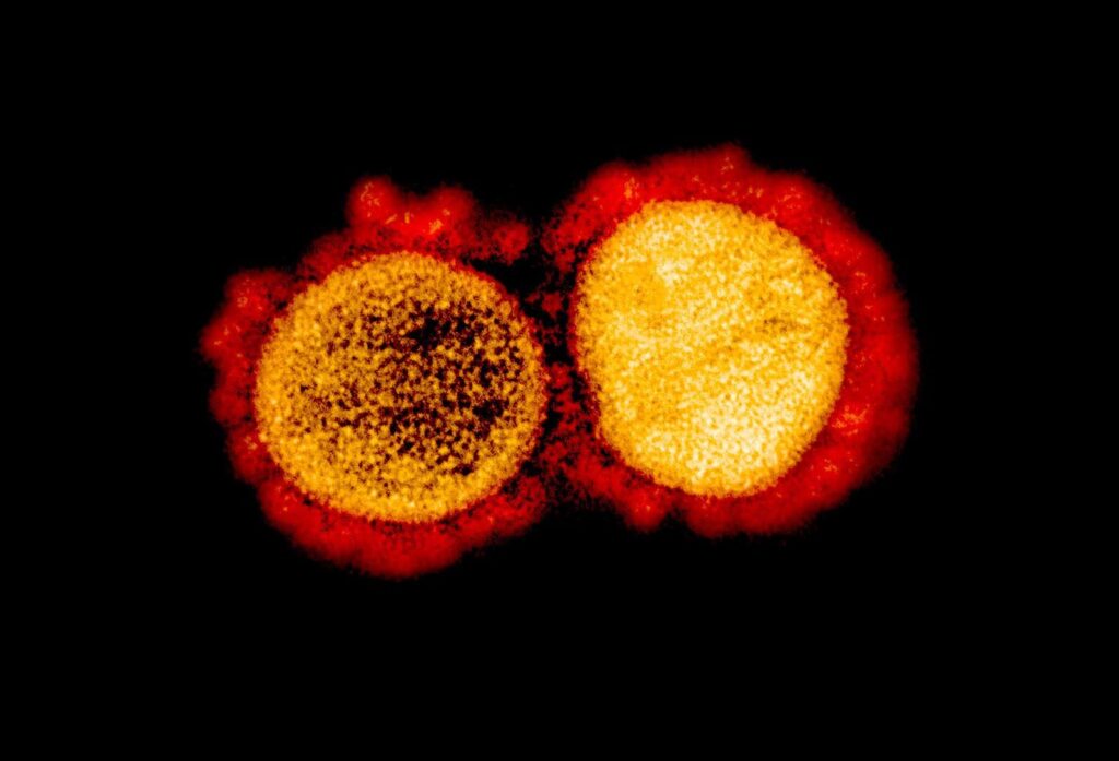 HIV e Coronavírus: distâncias e aproximações das epidemias e a vulnerabilidade de quem vive com HIV/aids