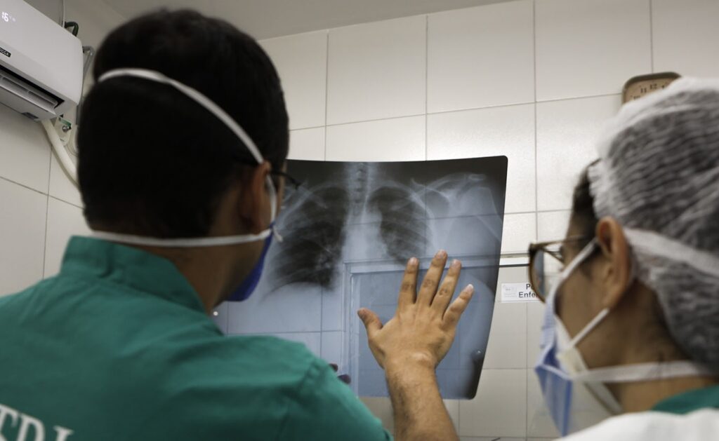 Brasil: mortes por Covid-19 podem ser mais que o dobro dos números oficiais