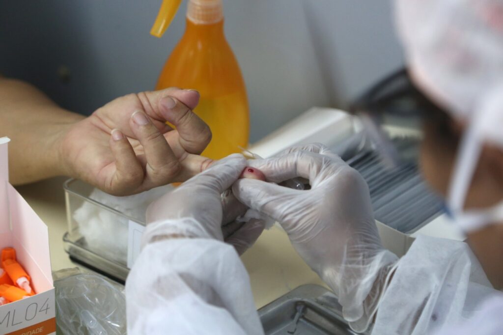 Brasil, último lugar em testes por caso confirmado