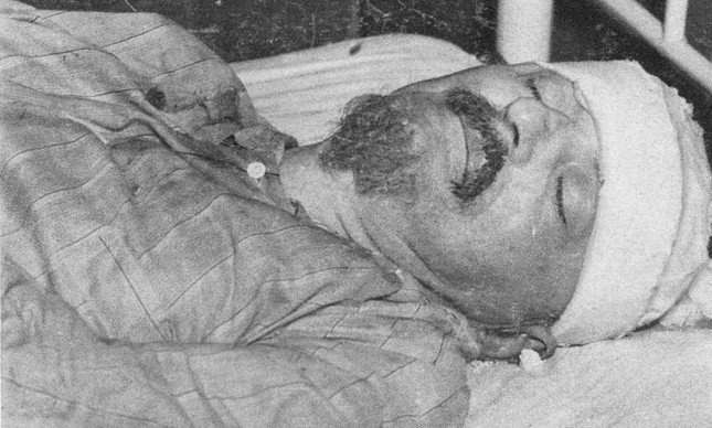 Corpo de Trotsky, com uma faixa branca na cabeça.
