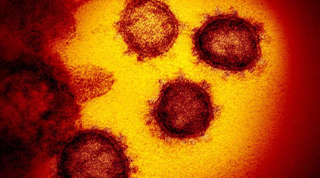 O ano da pandemia
