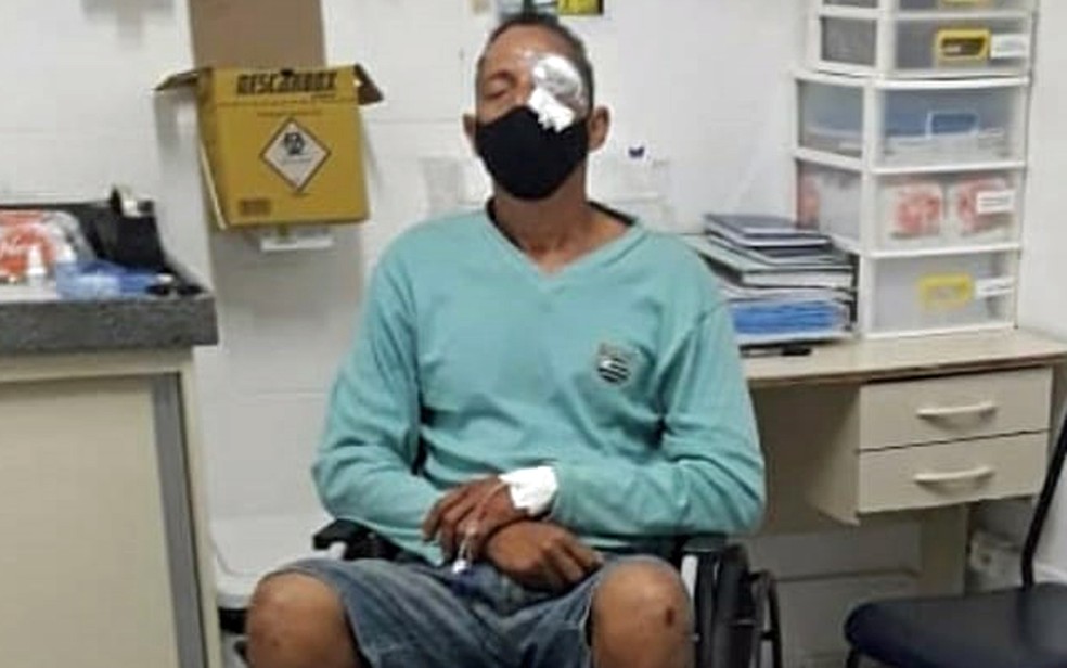 As balas em Recife tinham mira certeira: cegar os que enxergam o óbvio